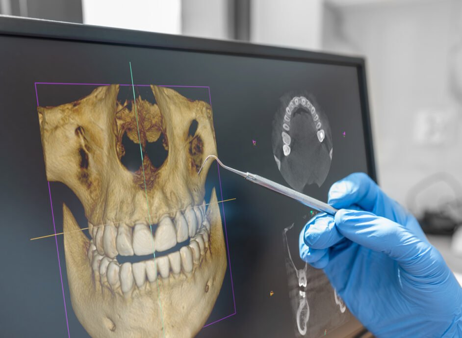 Dental consultation in clinic. Dentist showing 3D tomography image on screen