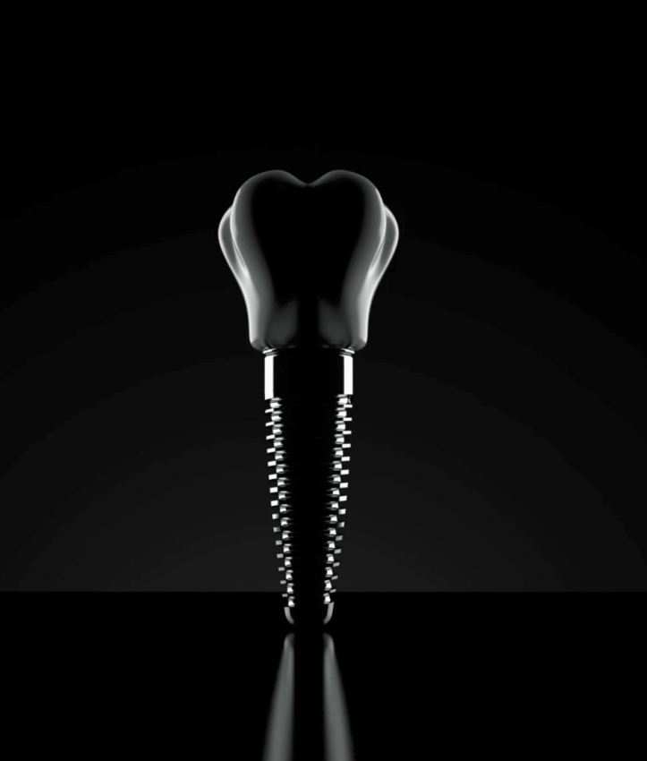 Illustration d’une couronne dentaire fixée sur un implant, sur fond noir.