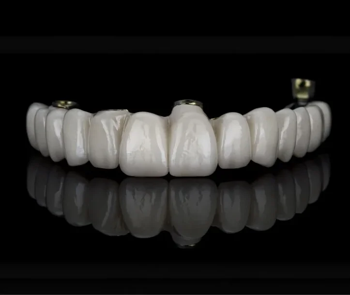 Couronnes dentaires sur implants, présentées en arc sur fond noir.
