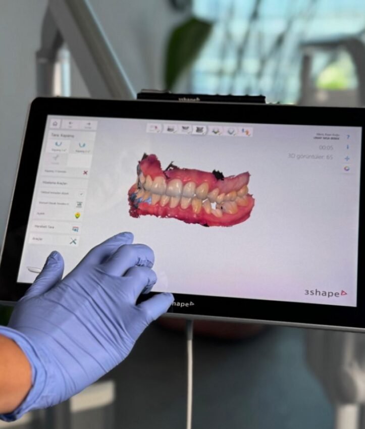 Praticien d’Art’s Clinic examinant une simulation numérique du sourire