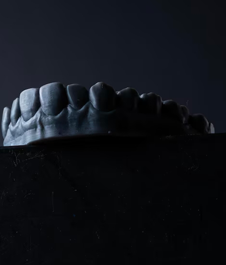 Modèle d’arcade dentaire imprimé en 3D.